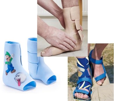 Fig. 1.Ortesis en silicona a medida, con cierre mediante velcros que evita el pie equino leve.