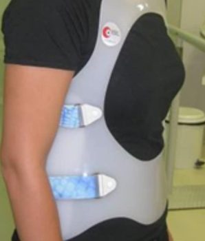 Fig. 2. Corsé dorsolumbar rígido, regulable con cierre de velcros, soporte esternal y apoyo púbico.