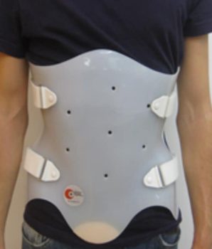 Fig.1- Corsé lumbar rígido de polietileno, bivalvo a medida.